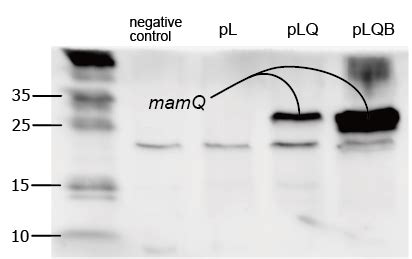 Team:Kyoto/Project/Magnetosome Formation - 2014.igem.org