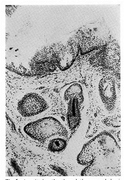 Figure 5 from On the Histology and Innervation of Caruncula Lacrimalis ...