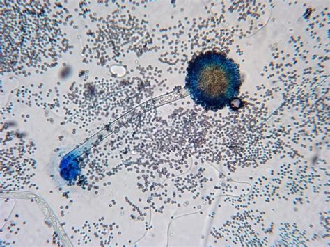 Fun With Microbiology (What's Buggin' You?): Aspergillus niger