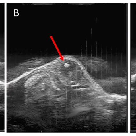 Representative B-mode ultrasound images: (A) DLM8 subcutaneous tumor... | Download Scientific ...