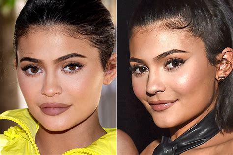 See Kylie Jenner's Filler-Free Lips in First Outing Since She Revealed ...