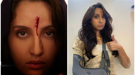 Nora Fatehi’s injury in Bhuj The Pride of India is real, she recalls ...