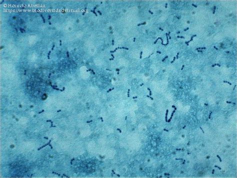 Lactobacillus Acidophilus And Bulgaricus