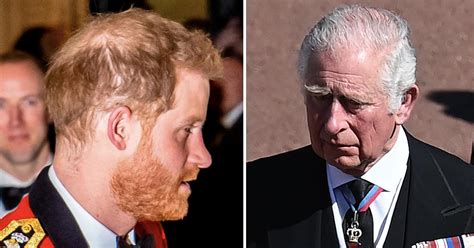 Prince Harry's Hair Loss Isn't Due To Stress, Expert Blames Prince Charles