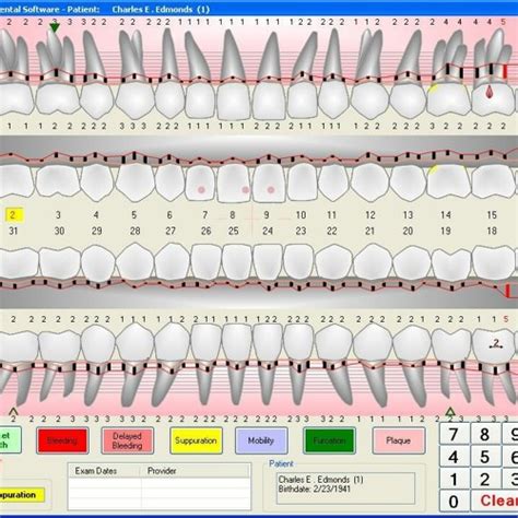 Stream Periodontal Charting Software Free Download by Jennifer | Listen ...