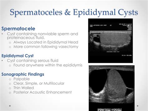 Epididymal Head Cyst