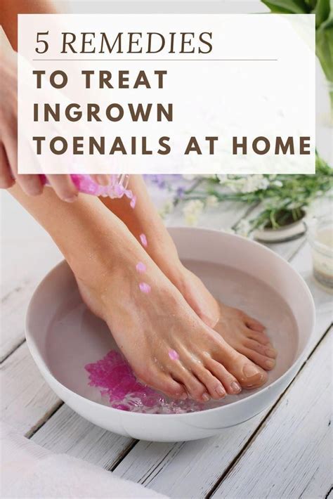 Follow these natural steps to treat ingrown toenails at home! #home #remedies #ingrown #toenails ...