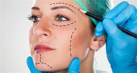 5 Pros & Cons of Cosmetic Surgery - Amazing Posting