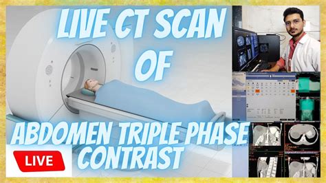 CT SCAN Triple phase Abdomen Contrast Scanning process || Live CT Scan of Triphasic Abdomen # ...