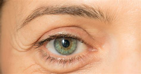 10 Home Remedies for Puffy Eyes - Facty Health