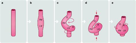 Cardiac Embryology | Radiology Key