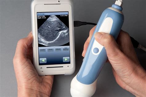 MobiUS SP1 morphs Toshiba TG01 into a portable ultrasound device - The ...