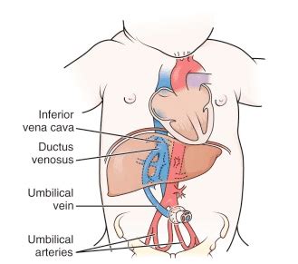 Pediatrics Notes: Umbilical Vein Catheterization