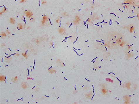 Microbiology Case Study: an 11 Month Old with a 3 Day History of Gastroenteritis and High Fever ...