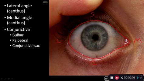 Orbit and Eye - Conjunctiva - YouTube