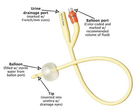 2-way foley catheters Archives - Personally Delivered Blog