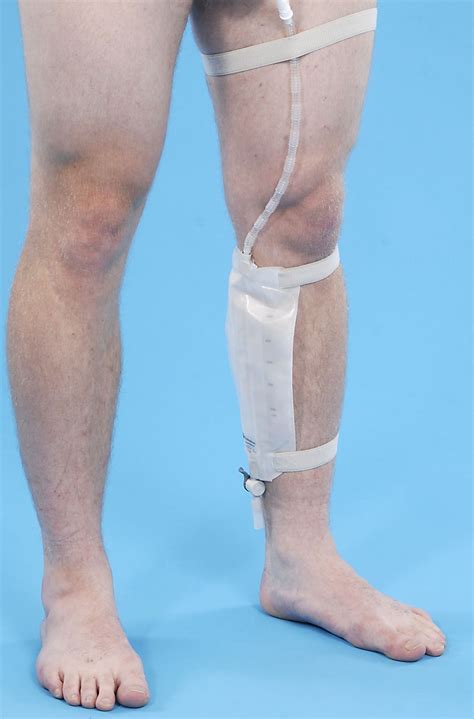 Images:What is a catheter?