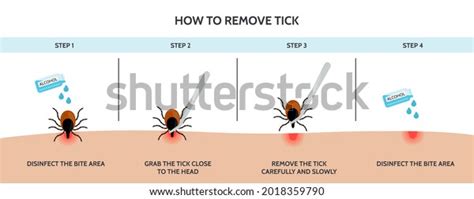 Correct Way Remove Tick Insect Correctly Stock Vector (Royalty Free ...