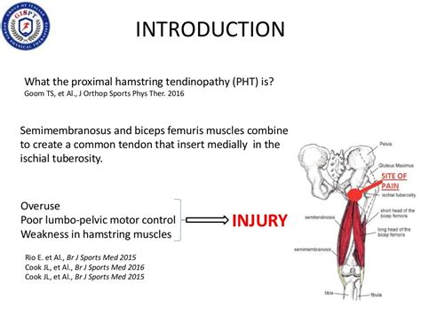 BILATERAL PROXIMAL HAMSTRING TENDINOPATHY IN ULTRAMARATHON RUNNER