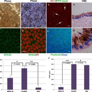 Expression of RPE markers. Morphology of enriched sheets of mature RPE... | Download Scientific ...