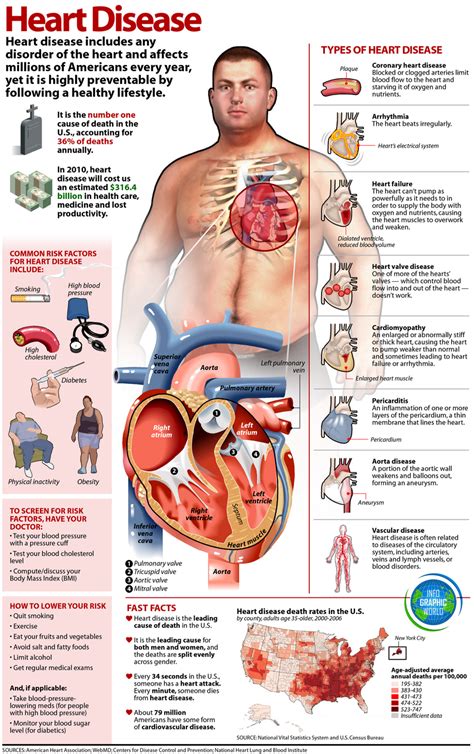 All About Heart Disease Infographic – NaturalON - Natural Health News ...