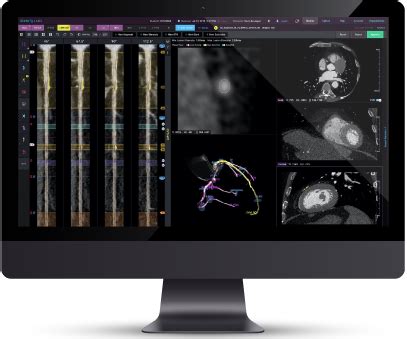 Cleerly Comprehensive Coronary Angiographic Evaluation - Dr. Lee Marcus