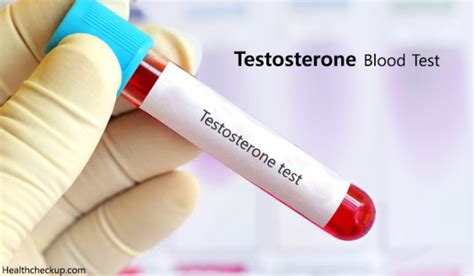 Testosterone Blood Test Procedure, Preparation & Normal Levels of ...