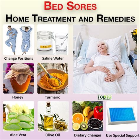 Bed Sores Home Treatment and Remedies | Top 10 Home Remedies