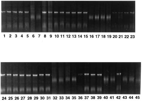 Rapid differentiation of M. bovis from M. tuberculosis strains by... | Download Scientific Diagram