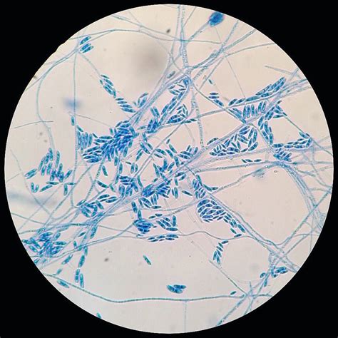 ️ on Instagram: “Fusarium spp. #micologia #micology #fusarium #microbiology #microbiologia # ...