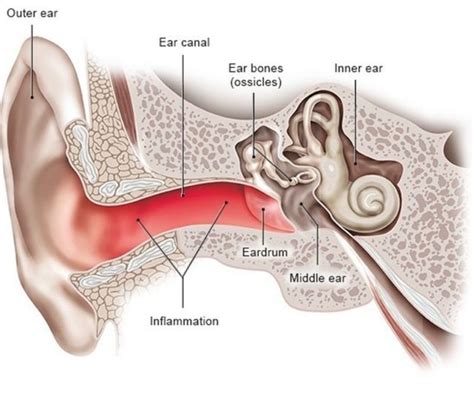 A Guide to External Ear Infections from an ENT Specialist in Singapore - Health Life and Recipes