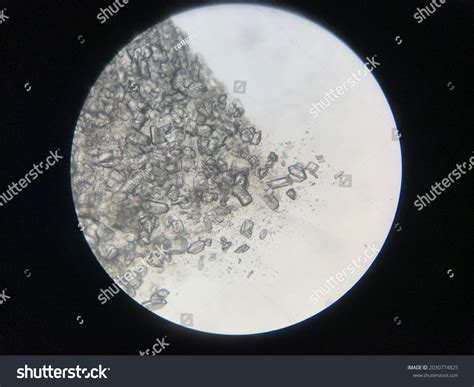 Struvite Crystals Urine Sample Male Cat Stock Photo 2030774825 ...