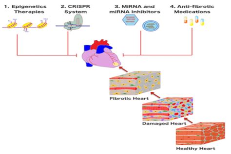 Biomedicines | Free Full-Text | Novel Therapies for the Treatment of Cardiac Fibrosis Following ...