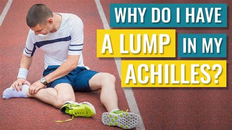 Why do I Have a Lump in my Achilles Tendon? - YouTube