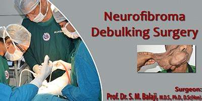 Neurofibroma Debulking Surgery, Dr SM Balaji, Maxillofacial Surgeon