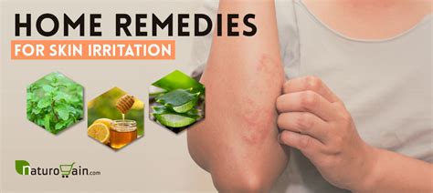 9 Outstanding Home Remedies for Skin Irritation and Redness