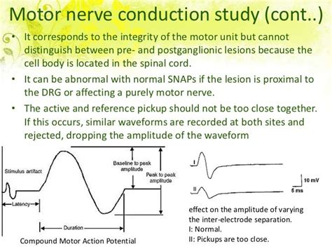 Nerve conduction study