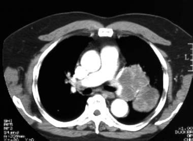 What Is A Ct Scan With Contrast Called