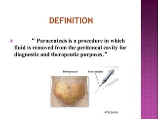 Abdominal paracentesis | PPT