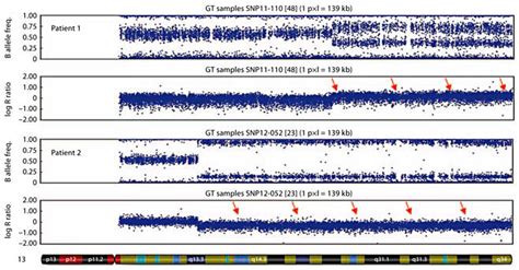 SNP array analysis of chromosome 13. Arrows show the mosaic duplication... | Download Scientific ...