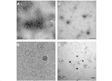 Electron micrograph of the released bacteriophages. a Negative (uranyl... | Download Scientific ...