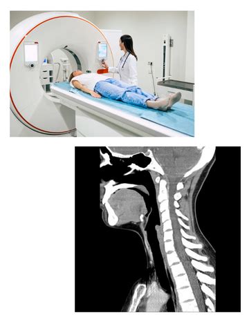 CT scan for Neck | cost @1799/- | Medintu