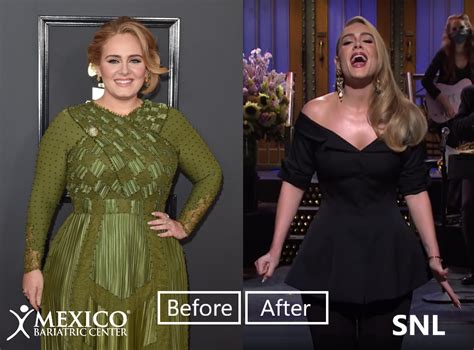 Adele Weight Loss 2020 - Did She Have Bariatric Surgery?