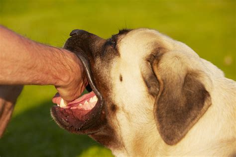 Dog Bite Prevention Tips | Fort Lee Dog Bite Injury Lawyers