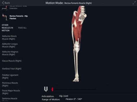 Hip Flexion Deformity