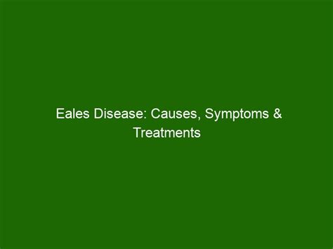 Eales Disease: Causes, Symptoms & Treatments - Health And Beauty