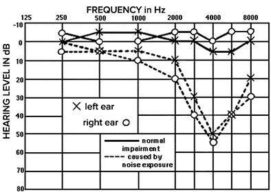 Hearing Evaluation | Marin Hearing Center