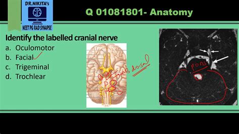 Cranial Nerve Iii Mri