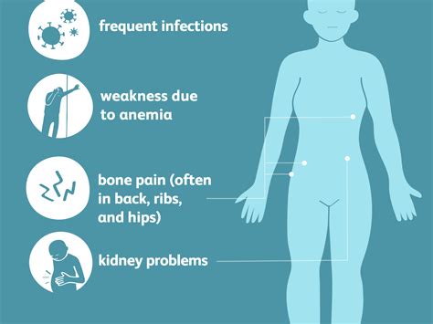 Multiple Myeloma -Symptoms, Causes, Risk Factors & Complications