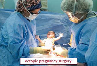 Ectopic Pregnancy Surgery In India | EdhaCare